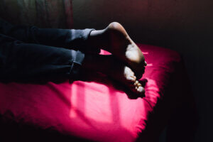 A photo from Burayou orphanage in Addis Ababa, Ethiopia, showing the legs of a child affected by an illness being treated by a doctor
